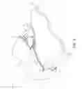 Fig. 10 - Surgical stapler end effector with multi-staple driver crossing center line