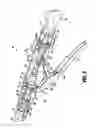Fig. 03 - SURGICAL STAPLING APPARATUS