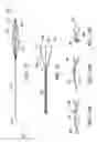 Fig. 34 - Clot retrieval system