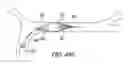 Fig. 49 - Clot retrieval system