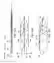 Fig. 70 - Clot retrieval system