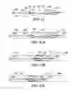 Fig. 78 - Clot retrieval system