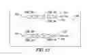 Fig. 80 - Clot retrieval system