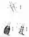 Fig. 62 - Medical instruments for performing minimally-invasive procedures