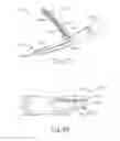 Fig. 55 - Surgical instrument with dual mode end effector and side-loaded clamp arm assembly