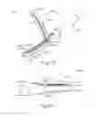 Fig. 63 - Surgical instrument with dual mode end effector and side-loaded clamp arm assembly