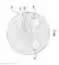 Fig. 04 - Scoring balloon catheter