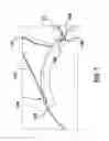 Fig. 08 - Scoring balloon catheter