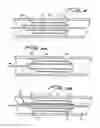 Fig. 06 - Cutting wire assembly for use with a catheter