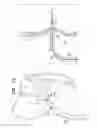 Fig. 06 - Fossa ovalis penetration