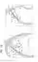 Fig. 16 - Fossa ovalis penetration