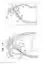 Fig. 17 - Fossa ovalis penetration