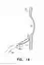 Fig. 19 - Fossa ovalis penetration