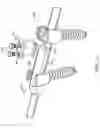 Fig. 14 - Spinal rod implant extension
