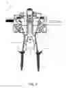 Fig. 04 - Method and apparatus for performing spinal surgery
