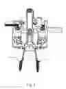 Fig. 05 - Method and apparatus for performing spinal surgery