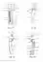 Fig. 15 - Method and apparatus for performing spinal surgery