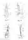 Fig. 17 - Method and apparatus for performing spinal surgery