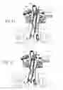 Fig. 27 - Method and apparatus for performing spinal surgery
