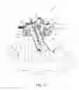 Fig. 29 - Method and apparatus for performing spinal surgery