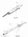 Fig. 35 - Method and apparatus for performing spinal surgery