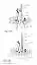 Fig. 49 - Method and apparatus for performing spinal surgery