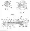 Fig. 03 - Orthopedic locking screw for an orthopedic fastening system and method of securing an orthopedic locking screw