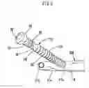Fig. 06 - Orthopedic locking screw for an orthopedic fastening system and method of securing an orthopedic locking screw