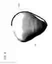Fig. 06 - Patella fracture reduction plates