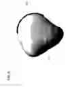 Fig. 08 - Patella fracture reduction plates