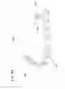 Fig. 12 - Patella fracture reduction plates