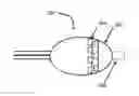 Fig. 01 - CATHETER DEVICE INCLUDING FLOW SENSING