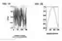 Fig. 02 - CATHETER DEVICE INCLUDING FLOW SENSING