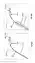 Fig. 07 - CATHETER DEVICE INCLUDING FLOW SENSING