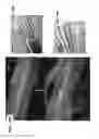 Fig. 21 - CATHETER DEVICE INCLUDING FLOW SENSING