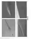 Fig. 23 - CATHETER DEVICE INCLUDING FLOW SENSING