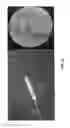 Fig. 25 - CATHETER DEVICE INCLUDING FLOW SENSING