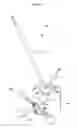 Fig. 13 - COMPUTER AIDED SURGICAL NAVIGATION AND PLANNING IN IMPLANTOLOGY