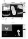 Fig. 28 - COMPUTER AIDED SURGICAL NAVIGATION AND PLANNING IN IMPLANTOLOGY