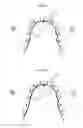 Fig. 04 - Method of fabricating custom dental correction device, and custom dental correction device fabricated by same