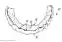 Fig. 01 - Stents for placement of orthodontic attachments, and methods of producing and using such stents