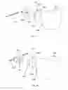 Fig. 09 - Detachable orthodontic bracket and wire system