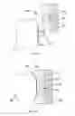 Fig. 19 - Detachable orthodontic bracket and wire system