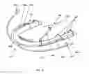 Fig. 23 - Detachable orthodontic bracket and wire system