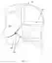 Fig. 24 - Detachable orthodontic bracket and wire system