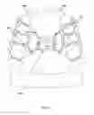 Fig. 28 - Detachable orthodontic bracket and wire system