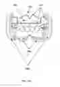 Fig. 29 - Detachable orthodontic bracket and wire system