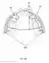 Fig. 30 - Detachable orthodontic bracket and wire system
