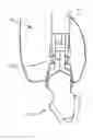 Fig. 01 - Fastening system for dental implants