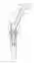 Fig. 01 - SCREW AND DRIVER TOOL FOR DENTAL PROCEDURES